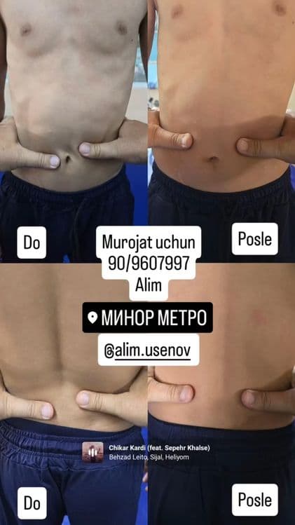 Если вялость и усталость, ноет рука Вам к нам  ЛФК профилактика  остео — 4
