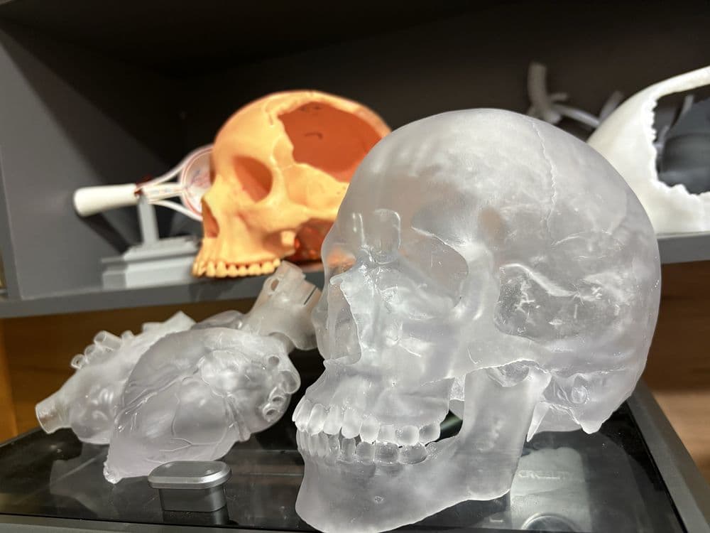 3D printer dizayn va rekonstruksiya hizmati Medical prototivlar. — 2