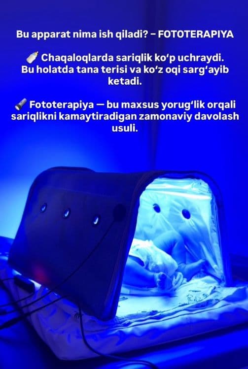 Arenda  FOTOLAMPA Navoiy shahri va 12 ta viloyat buylab — 2