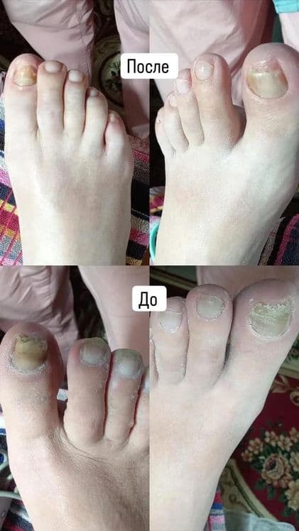 Педикюр  сложный педикюр — 7