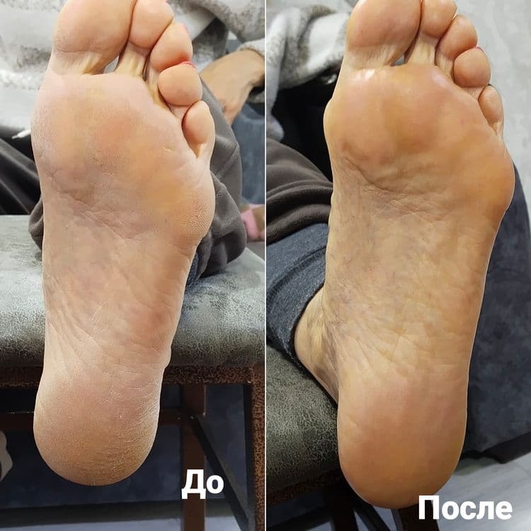 Приглашаю вас к себе на маникюр смарт педикюр — 2