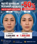-50% CHEGIRMADA Blefaroplastika