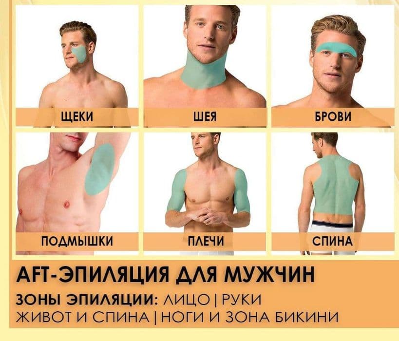 Лаезрная Эпиляция для Мужчин. AFT Удаление волос. — 1