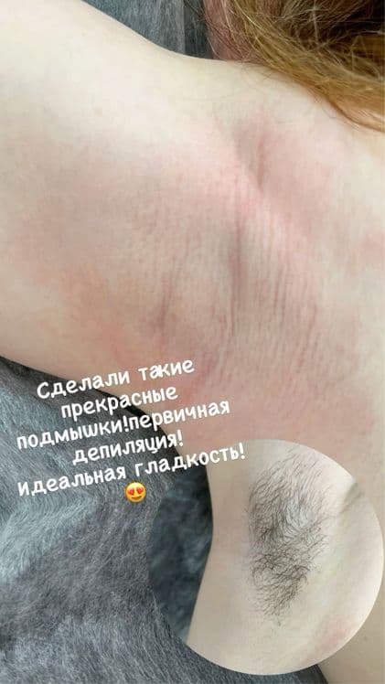 Депиляция Шугаринг Ламинирование бровей ресниц Архитектура бровей — 7