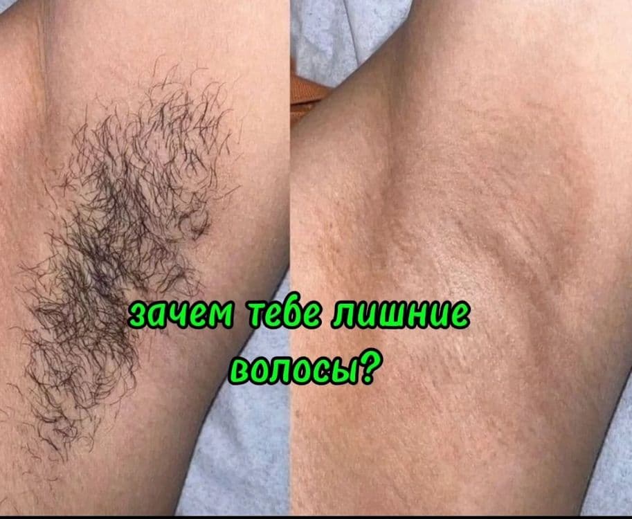 Мужчинам чистое  всё тело по адекватным ценам! — 2
