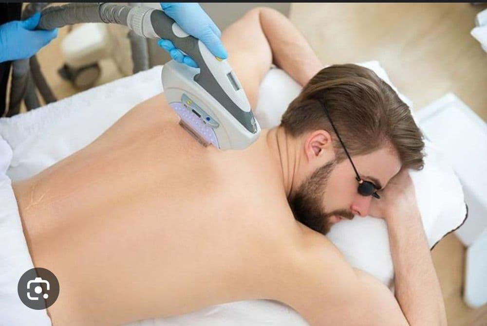Депиляция  и эпиляция лазерная — 1