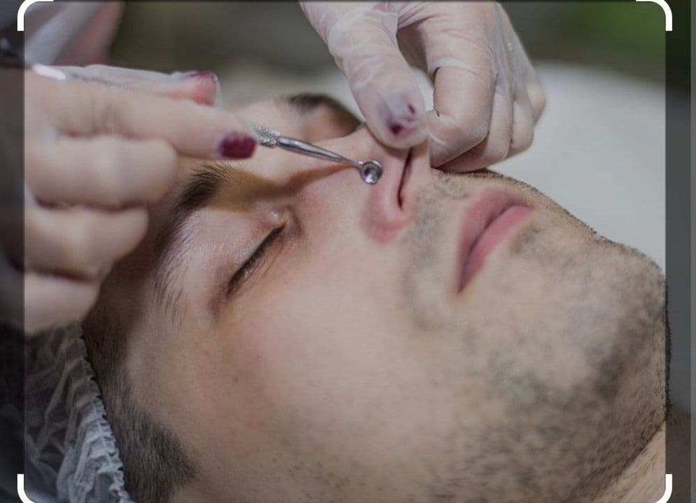 Депиляция все зоны мужская эпиляция — 1
