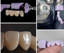 CAD/CAM в стоматологии моделирование зубов зуботехническая лаборатория