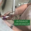 Интимное омоложение. Безоперационное лазерное интимное сужение.