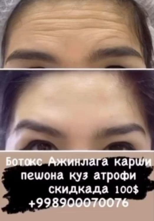 Лазер | Ботокс | Пилинги | Удаление татуажа | Косметолог — 8