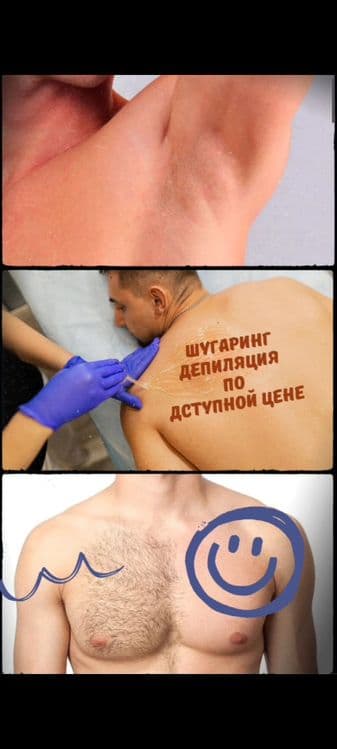 Чисто шугаринг. Мужская депиляция. — 2