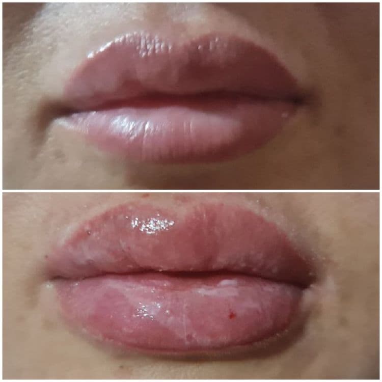 Botox v Tashkente,Kosmetolog — 1