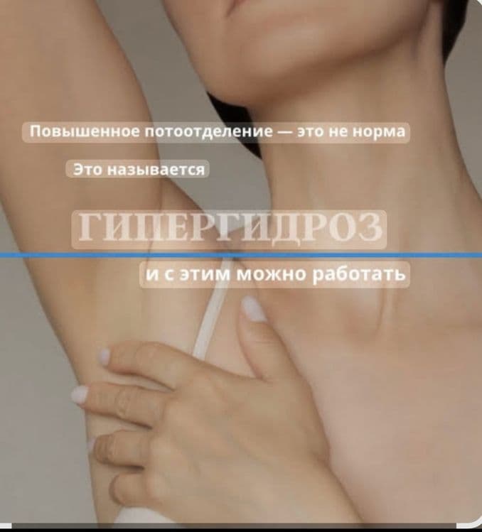 Гипергидроз култик терлаши 80$ — 3