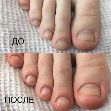 Маникюр и педикюр с выездом на дом — 1