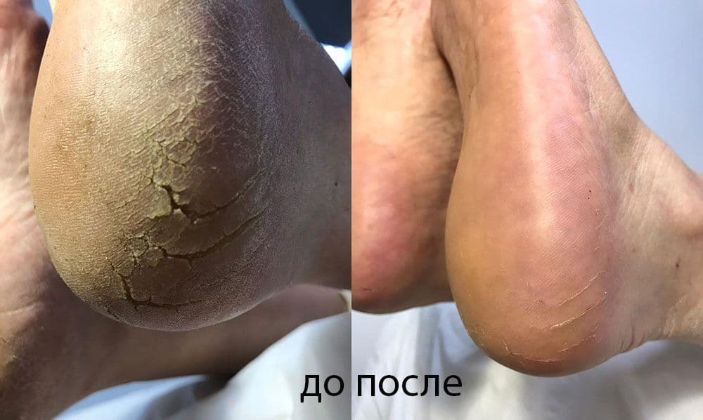 Маникюр и педикюр с выездом на дом — 5