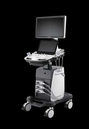 Sonoscape узи P9 elite — 2