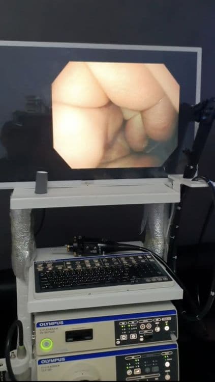 Olimpus evis exera III 190  Супер скидка — 4