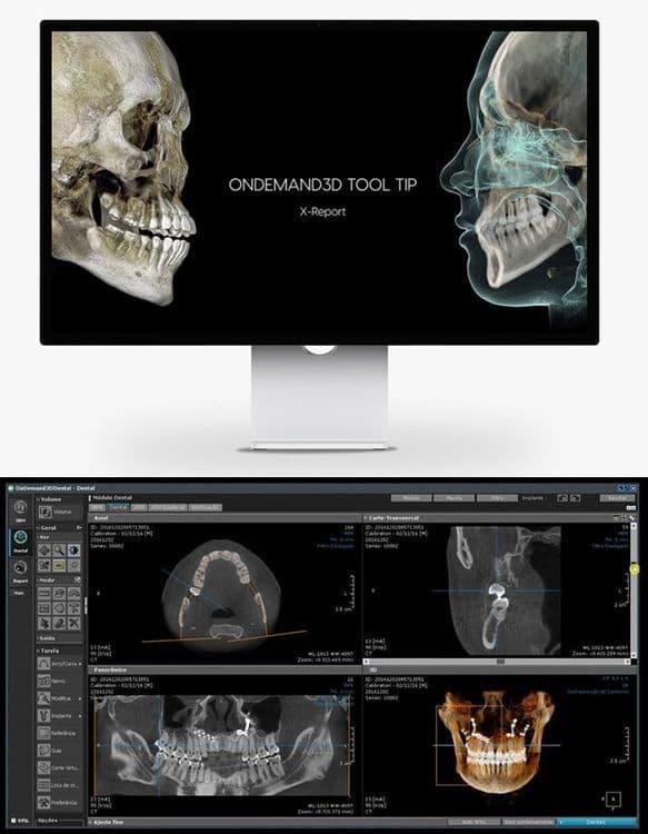 3D Dentri Ecoх –от HDX WILL 35 000$ — 4