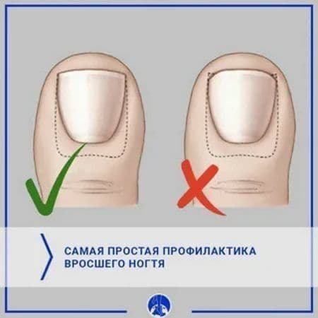Этга усган тирноклар — 2