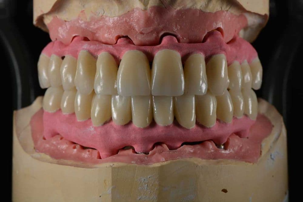 CAD/CAM в стоматологии зуботехнических лаборатория зубных протезов — 1