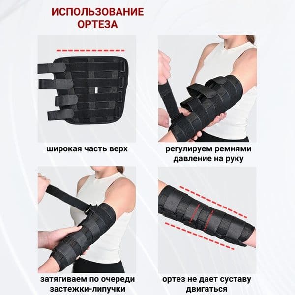 Ортез на локтевой сустав разъемный бандаж локтя с металлическими шин — 13