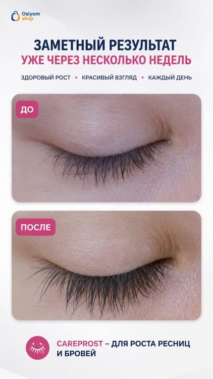 Саreprost Plus средство для роста ресниц и бровей — 3