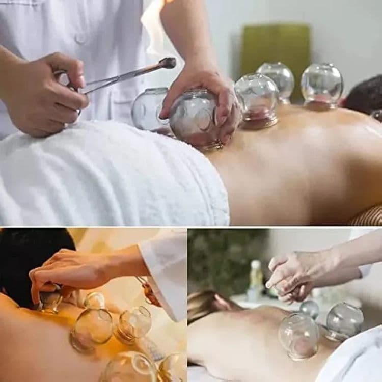Вакуумные медицинские банки — 2