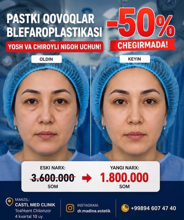-50% CHEGIRMADA Qovoqlar Blefaroplastikasi — 1