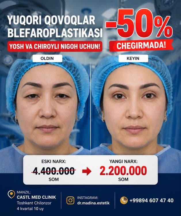-50% CHEGIRMADA Qovoqlar Blefaroplastikasi — 2