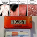 Крем от псориаза DENSE TINEA HEALING CREAM