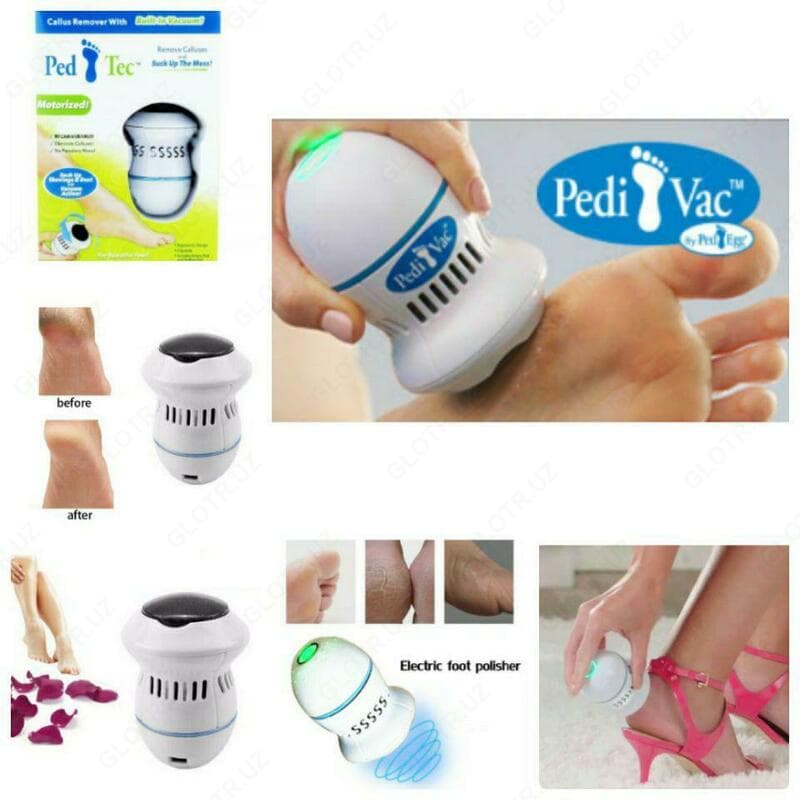 Электрическая пилка для ног ”Pedi vac” — 1