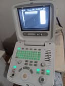 Chison 8300 УЗИ аппарат