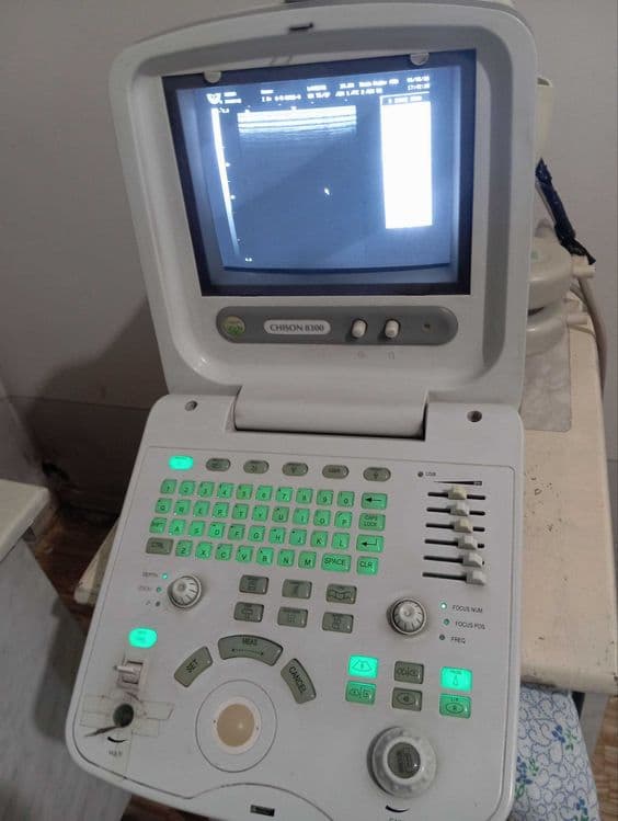 Chison 8300 УЗИ аппарат — 1