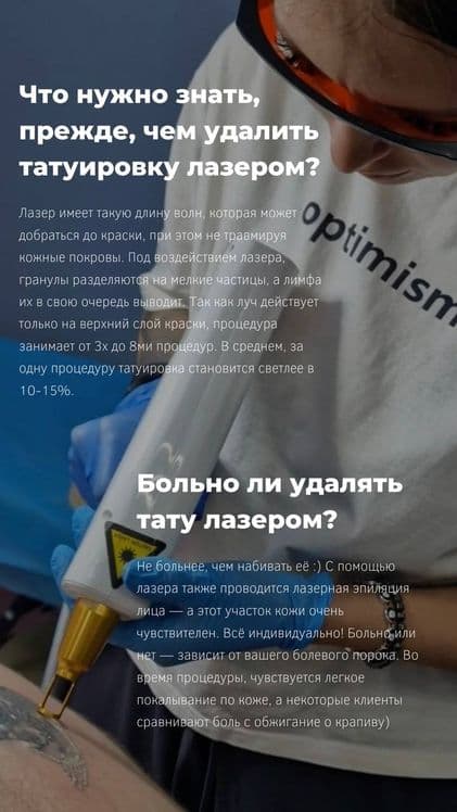 Удаление татуировок любой сложности от 200 тысяч сум — 1