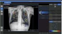DR PEDRA 17 FG с искусственным интеллектом 10.000$